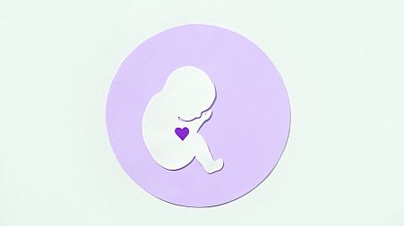 Babies born after fertility treatment have higher risk of heart defects