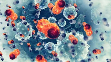 Certain diets could exploit tumour cell vulnerability, a new study shows