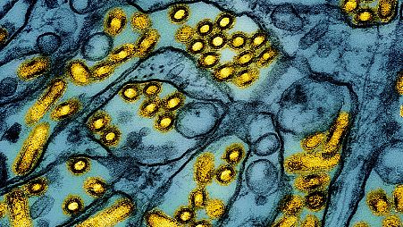 FILE -This colourized electron microscope image shows avian influenza A H5N1 virus particles (yellow), grown in Madin-Darby Canine Kidney (MDCK) epithelial cells (blue).